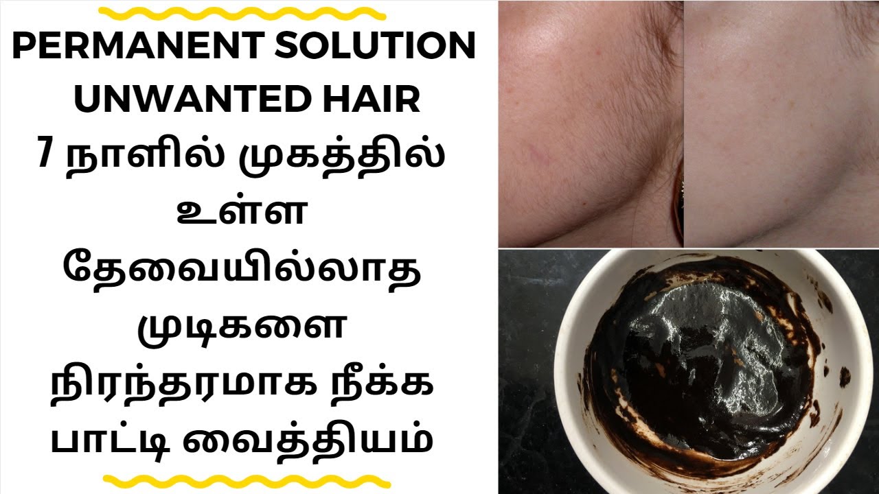 Natural And Permanent Solution For Unwanted Hair In Tamil