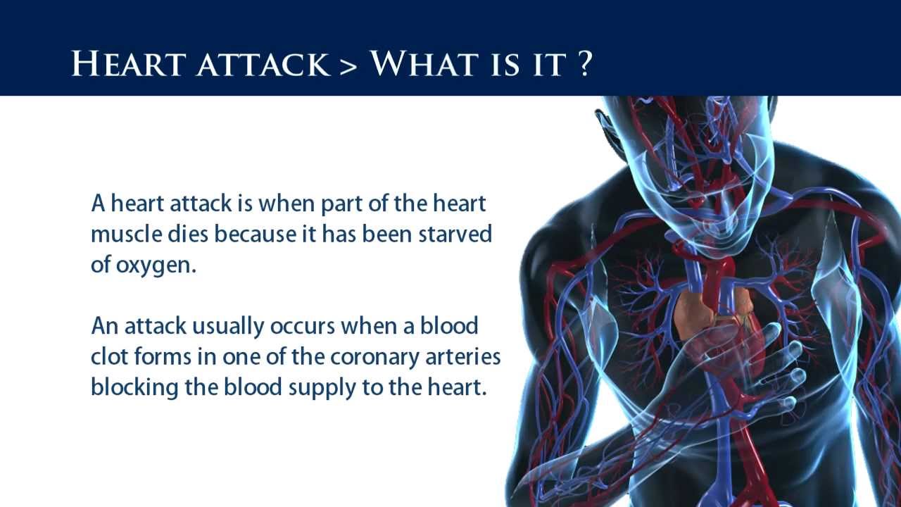 First Aid Training Heart Attack YouTube