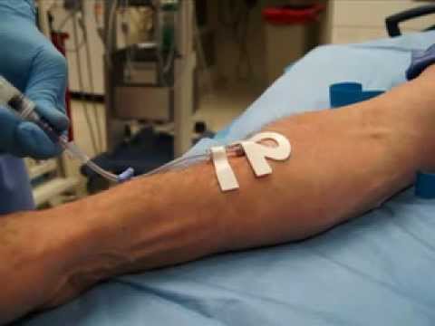 Ultrasound-Guided Peripheral IV Placement - YouTube