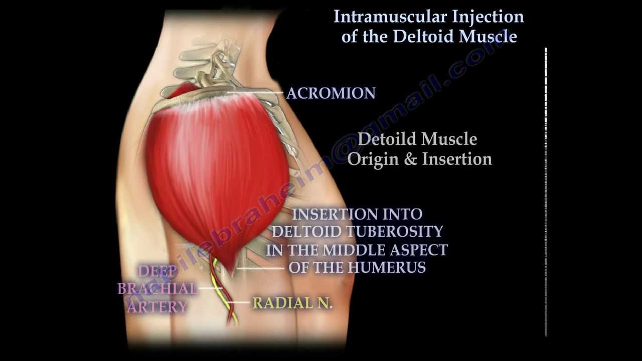 Intramuscular injection of the deltoid muscle - Everything You Need To