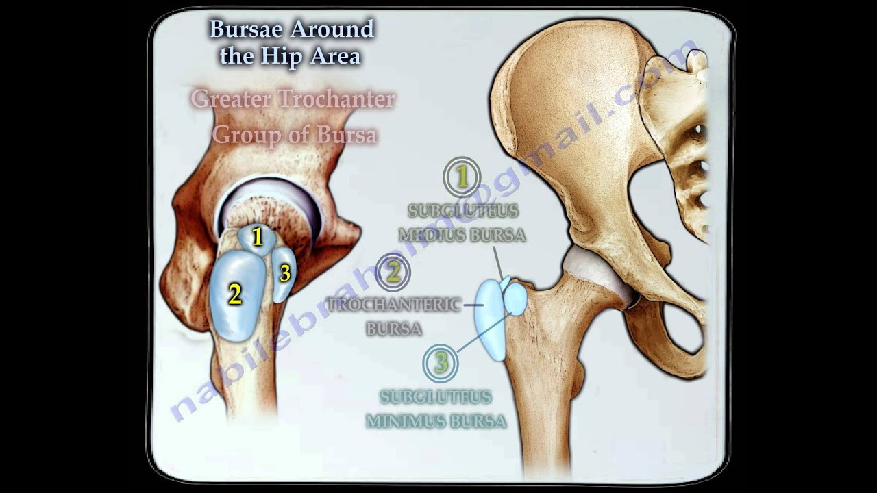 Bursitis Around The Hip - Everything You Need To Know - Dr. Nabil