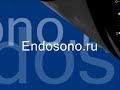 Нажмите для просмотра : Два друга. Киста Беккера и подсухожильный бурсит
