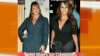 Cirugías de las Famosas: Antes y Después / Before and After