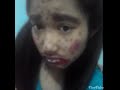 Vịt con xấu xí :v