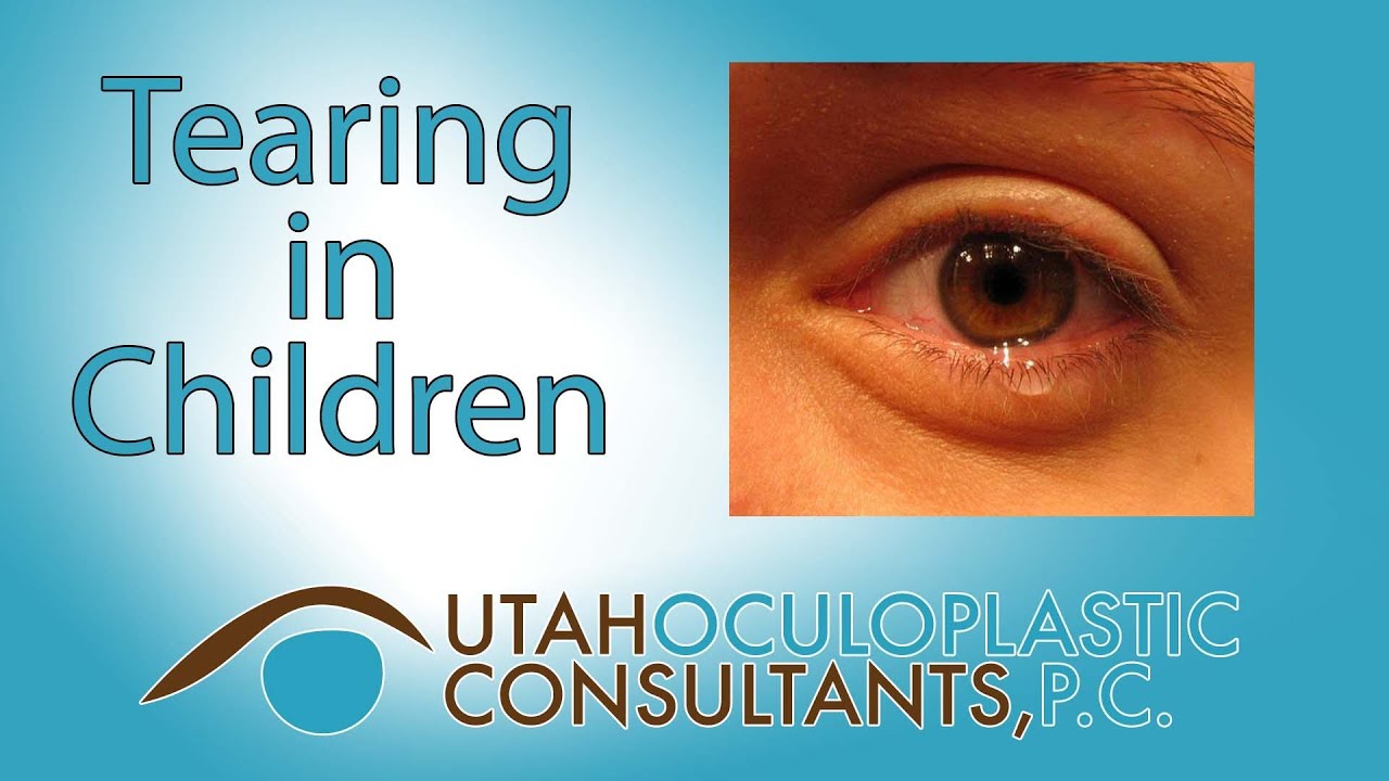 Clogged tear duct surgery in adults