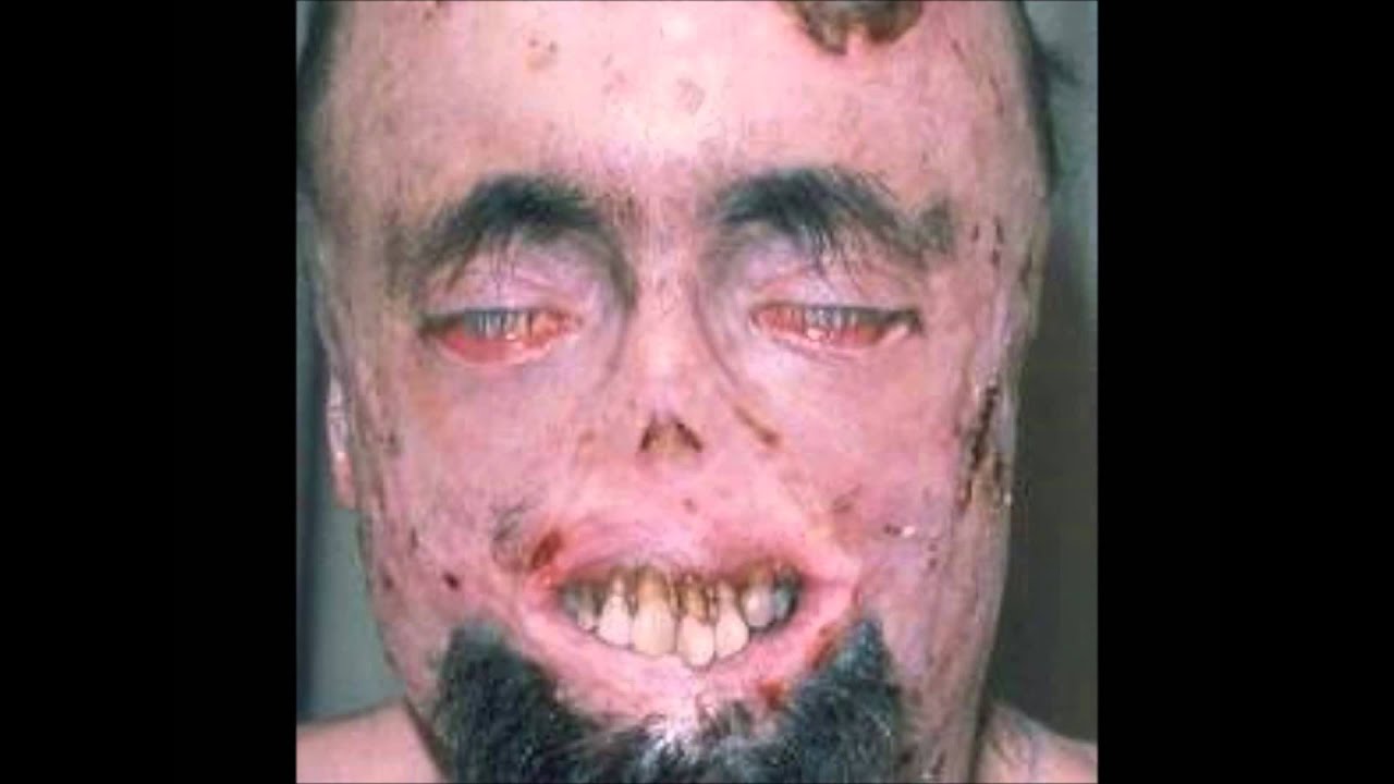 Imagenes Raras Feas | las personas mas feas i raras del mundo parte 2 youtube Imagenes Raras Feas | las personas mas feas i raras del mundo parte 2 youtube