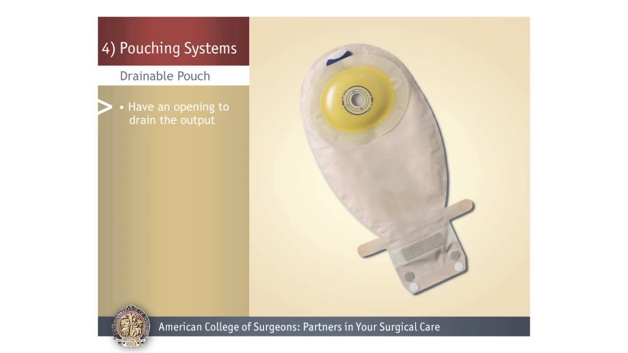 colostomy ileostomy pouching systems