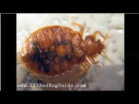 How Do Bed Bugs Bites Look - Bed Bug Guide - YouTube