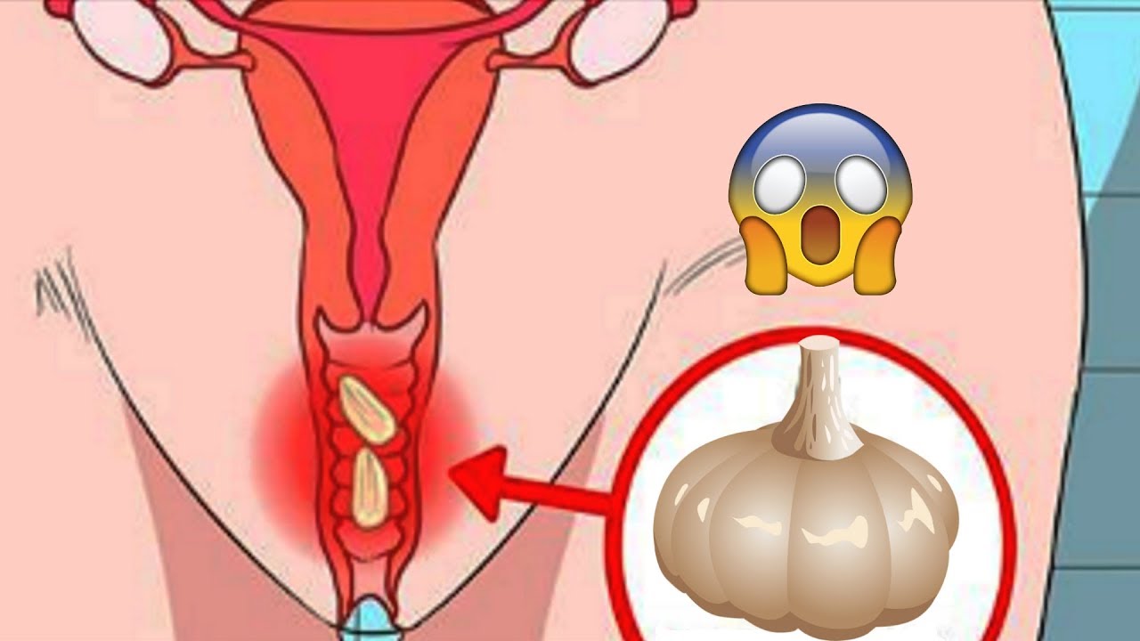 chlen-i-vagina-menshe