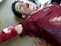 الشهيد الطفل إياد الفارس يلتقط أنفاسه الأخيره_قدسيا4\8