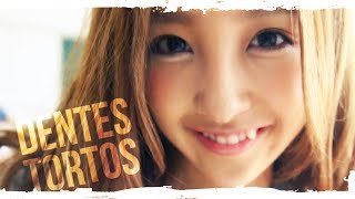 Japoneses e seus dentes tortos