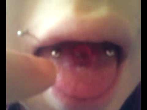 Keyword: 2g tongue stretch piercing piercings peircings pircing dermal 