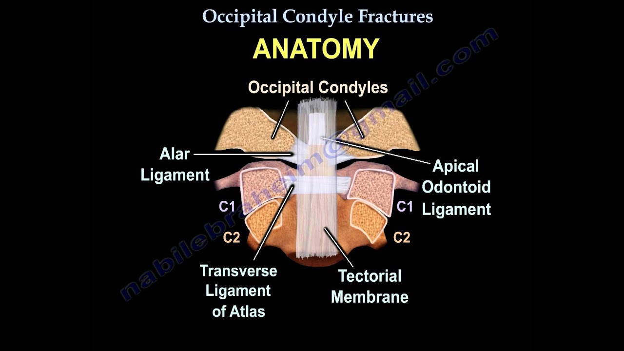 Occipital Condyle Fractures - Everything You Need To Know - Dr. Nabil