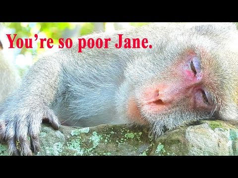 Poor Jane feels tired cos her leg make her not sleep well hurt so much so she couldn't sleep