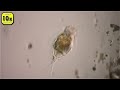 Euchlanis dilatata - A Rotifer