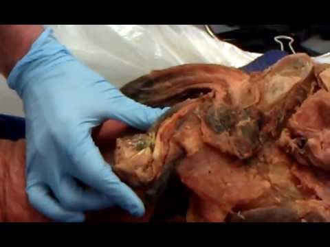 Urinary and Male Reproductive System Cadaver Anatomy 2 Kelly Trainor