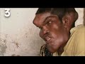 10 Bizarre Medical Anomalies - Top10Stuff