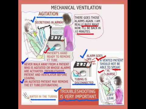 nursing ventilation mechanical care icu patient nurses ventilator nurse vent respiratory critical sessions abg pressure acute trouble mnemonics overview enve