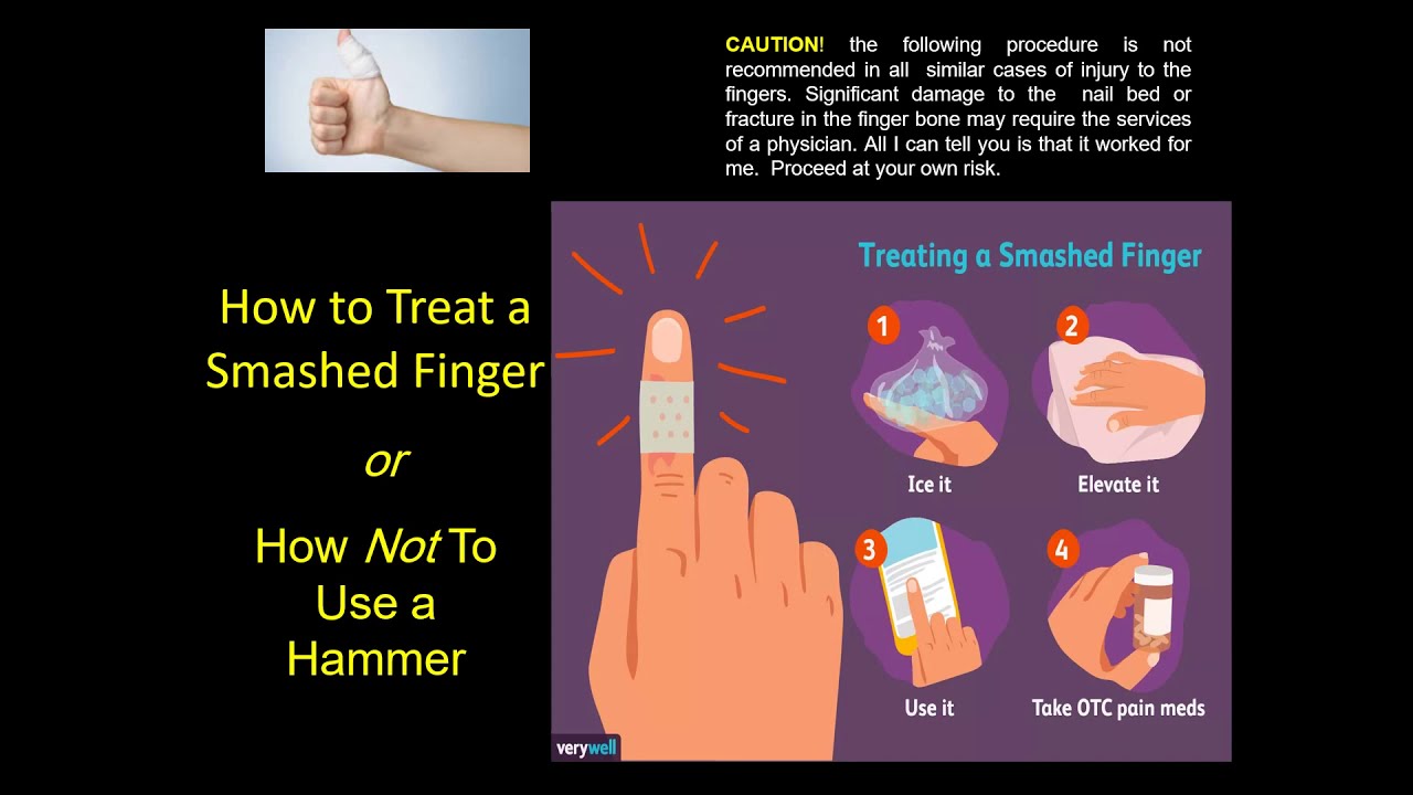 How Long Does It Take A Smashed Finger To Heal