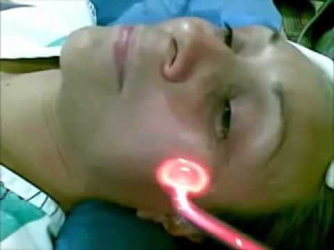 God Equipo de alta frecuencia facial portatil