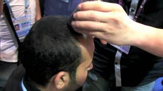 Hair Fall Solution