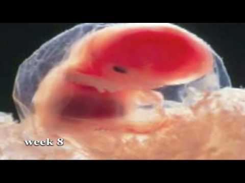Fetus Productions Fetalmania Fetus Productions Fetalmania