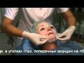 Контурная пластика лица (мезотерапия) Контурная пластика лица (мезотерапия)