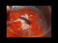 How to make CREAM CHEESE FROSTING recipe How to cook that ann reardon