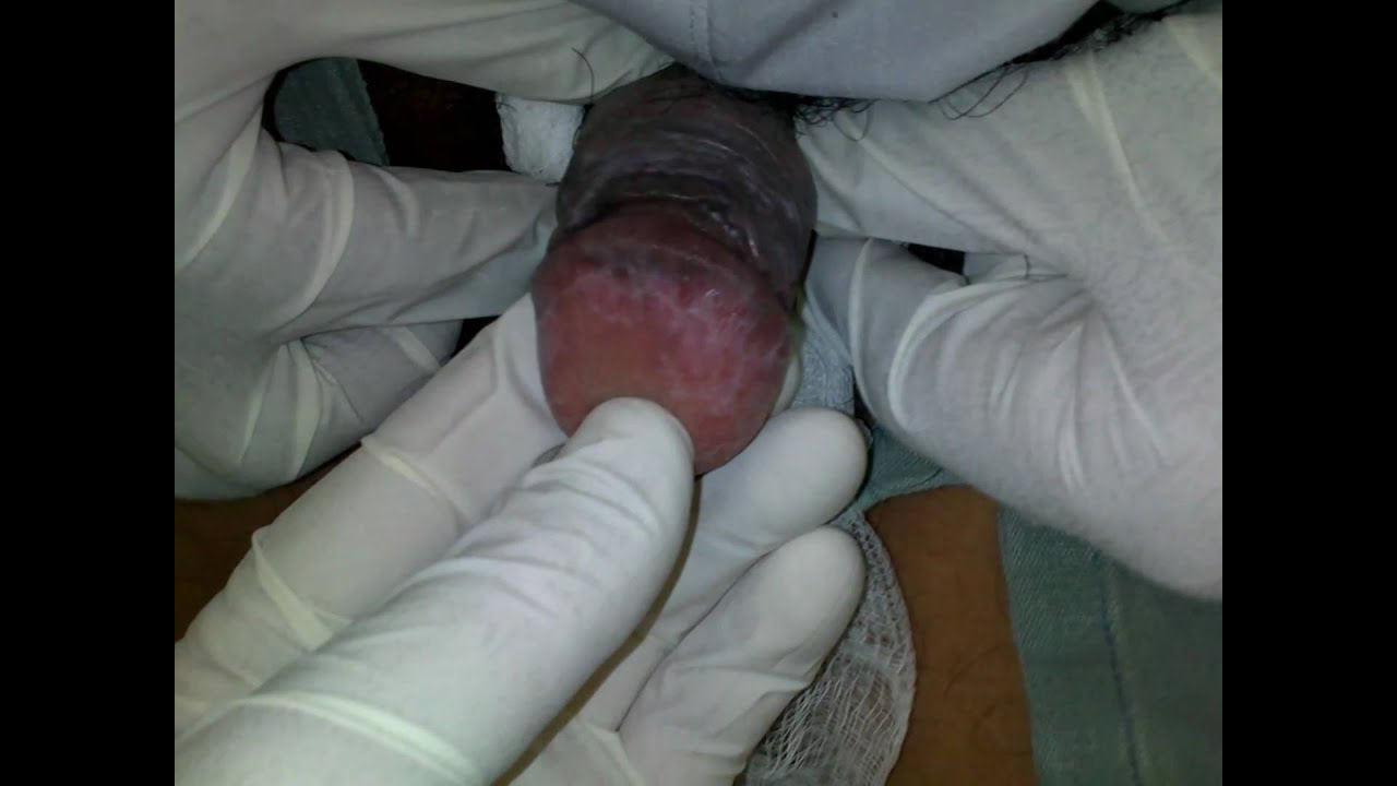 Las muchachas hermosas con las pecas de la morena
