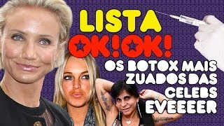 LISTA OK!OK!: As 6 celebs com o botox mais zuados EVEEEER