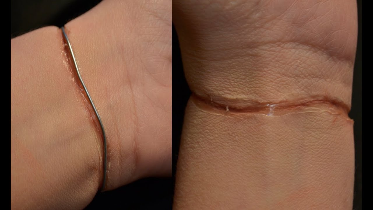 i got tied wire ligature mark youtube i got tied wire ligature mark youtube