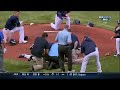 Worst Baseball Injury Ever