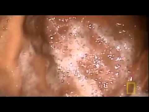 Inside a womans stomach - YouTube