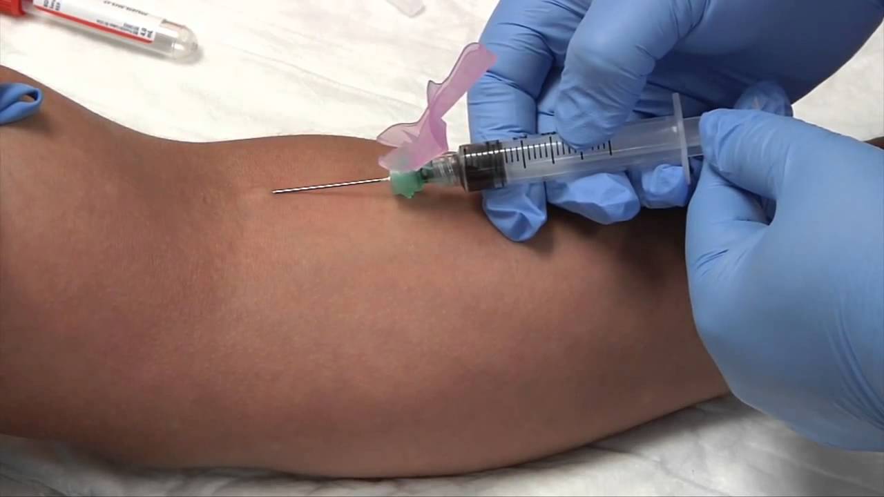 Phlebotomy Syringe Draw Procedure Blood Collection (RxTN) YouTube