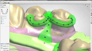 健康・医学 Best Denture Design mqdefault.jpg
