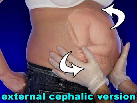 Fetal Development Week 36 (Pregnancy Health Guru) - YouTube