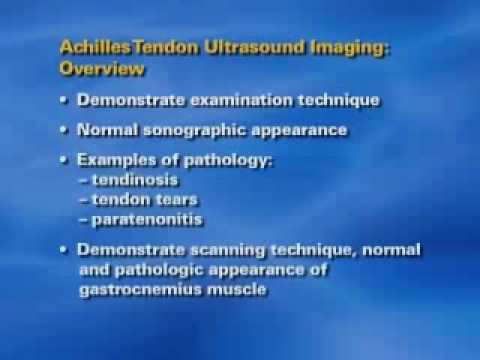 Achilles+tendonitis+ultrasound