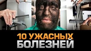 10 УЖАСНЫХ БОЛЕЗНЕЙ