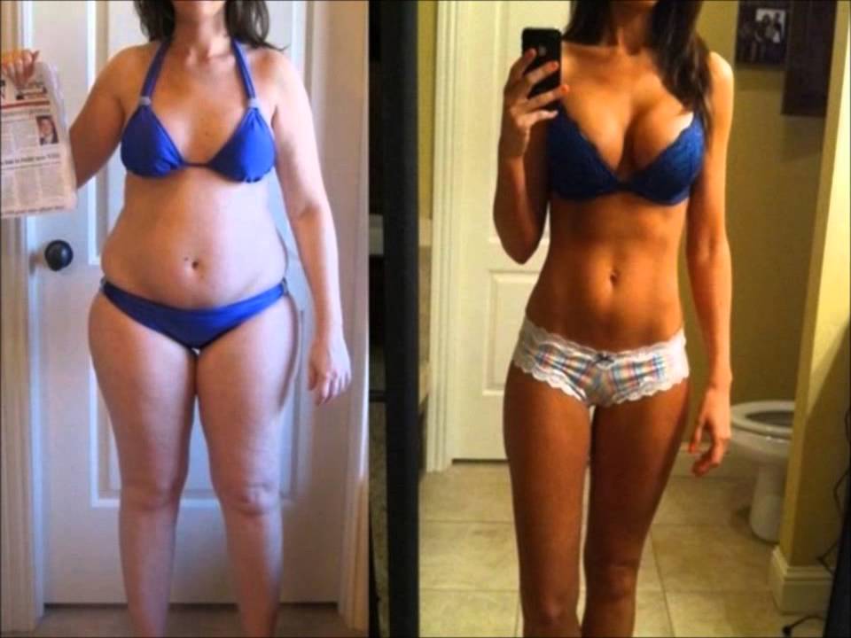 Augmentation After Weight Loss