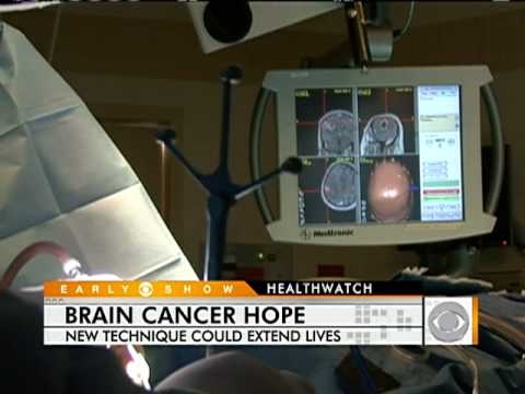 New Brain Cancer Treatment Offers Hope