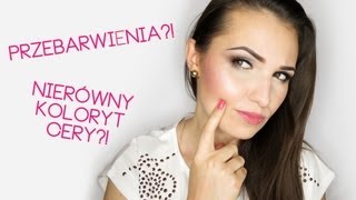 Pogadajmy o przebarwieniach - Czym są? Jak sobie z nimi radzić?