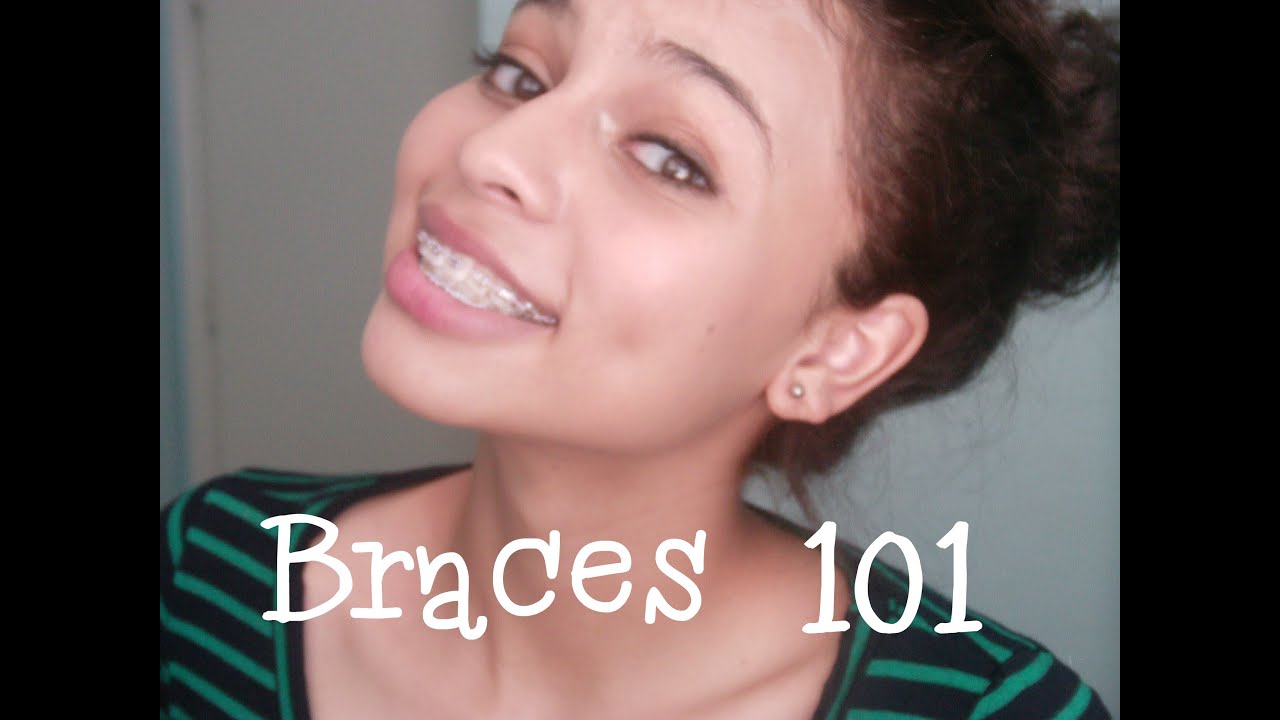 95 Tutorial Get Cheap Braces With Video Tips Tricks Tutorial Cheap