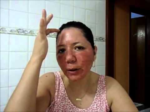 preço nova repair