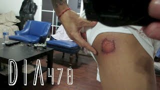 HERIDAS DE FUTBOL! (01/14/14)