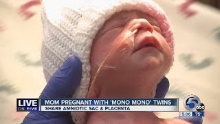 Orrville mom's rare twins born holding hands