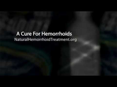 remedy for hemorrhoids
