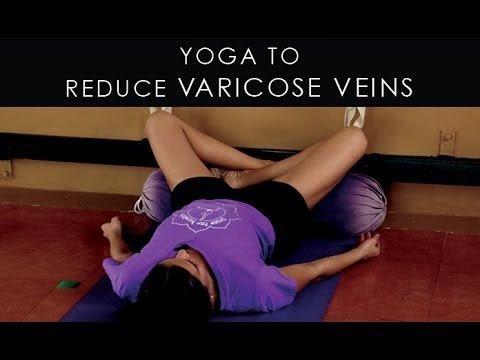 Yoga Reduce varicose Varicose    to poses Iyengar Veins veins YouTube yoga