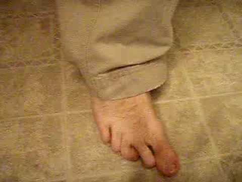 The ugliest feet EVER! (Hilarious) - YouTube