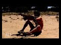 Big Lizard claws man (Painful to watch)