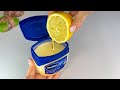 Mix Vaseline with Lemon and you will be shocked! If only I had known about this earlier!